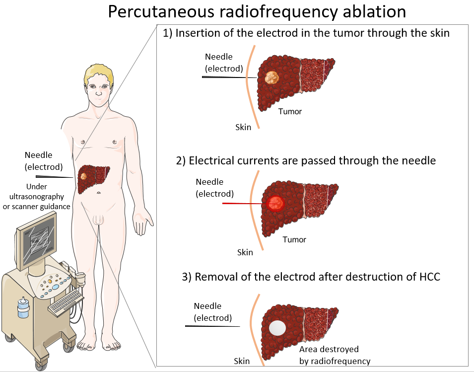 Information For Patients