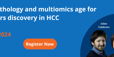 Join Digital pathology and multiomics age for biomarkers discovery in HCC